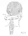 Fig. 03 - Pony tail wrap