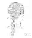 Fig. 04 - Pony tail wrap
