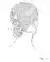 Fig. 05 - Pony tail wrap
