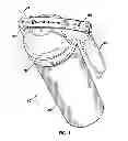 Fig. 02 - SELF SERVICING FIRE EXTINGUISHER WITH INTERNAL MIXING AND EXTERNAL CO2 CHAMBER
