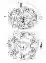 Fig. 02 - Planetary torsional damper system