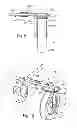 Fig. 09 - Mobilization device