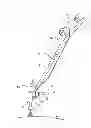 Fig. 02 - Device for manually painting a large surface, in particular an outer surface of an aircraft