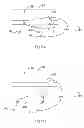 Fig. 05 - Universal ski conversion device for a stroller or bicycle trailer
