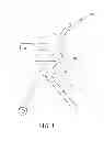 Fig. 02 - High chair