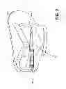 Fig. 04 - Device and method for imparting a rocking motion to an infant car seat