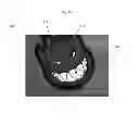 Fig. 06 - SYSTEMS AND METHODS FOR LUMINESCENT DISPLAY