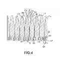 Fig. 04 - Phased array antenna