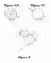 Fig. 02 - Contact lens
