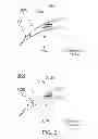 Fig. 04 - METHOD OF USING FULL RINGS FOR A FUNCTIONALIZED LAYER INSERT OF AN OPHTHALMIC DEVICE