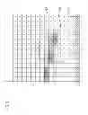 Fig. 09 - Hearing apparatus having an adaptive filter and method for filtering an audio signal