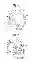 Fig. 02 - Cable length adjustment in auditory devices