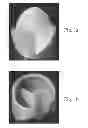 Fig. 02 - METHOD OF MANUFACTURING A TISSUE-ENGINEERED PROSTHESIS