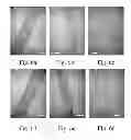 Fig. 07 - METHOD OF MANUFACTURING A TISSUE-ENGINEERED PROSTHESIS