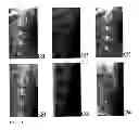 Fig. 02 - Methods Of Determining Skeletal Maturity