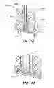 Fig. 48 - High density sensor array without wells