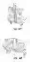 Fig. 50 - High density sensor array without wells