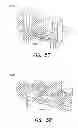 Fig. 55 - High density sensor array without wells