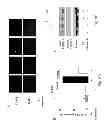 Fig. 08 - Therapeutic application of adiponectin in patients with ventricular fibrillation