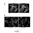Fig. 12 - Mutant NGAL proteins and uses thereof
