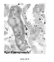 Fig. 16 - Mutant NGAL proteins and uses thereof