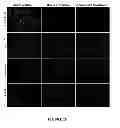 Fig. 32 - Mutant NGAL proteins and uses thereof