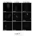 Fig. 34 - Mutant NGAL proteins and uses thereof
