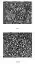 Fig. 02 - Method of deriving mature hepatocytes from human embryonic stem cells