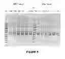 Fig. 06 - ANTISENSE OLIGONUCLEOTIDES FOR INDUCING EXON SKIPPING AND METHODS OF USE THEREOF
