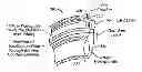 Fig. 01 - OPHTHALMIC ORBITAL SURGERY APPARATUS AND METHOD AND IMAGE-GUIDED NAVIGATION SYSTEM