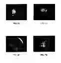 Fig. 06 - OPHTHALMIC ORBITAL SURGERY APPARATUS AND METHOD AND IMAGE-GUIDED NAVIGATION SYSTEM
