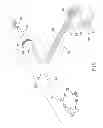 Fig. 02 - Methods and apparatus providing suction-assisted tissue engagement through a minimally invasive incision