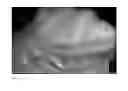 Fig. 03 - Method for evaluating blush in myocardial tissue