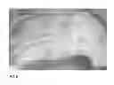 Fig. 09 - Method for evaluating blush in myocardial tissue