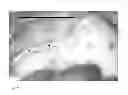 Fig. 10 - Method for evaluating blush in myocardial tissue