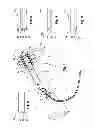 Fig. 02 - Detection of blood leakage by detecting a volatile agent