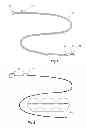 Fig. 02 - Catheter locator apparatus and method of use