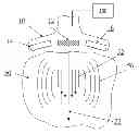 Fig. 01 - Determining material stiffness using multiple aperture ultrasound