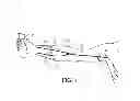 Fig. 02 - Deriving arterial pulse transit time from a source video image