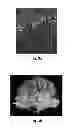 Fig. 03 - SYSTEMS AND/OR METHODS FOR STIMULATING THE BRAIN TO PROMOTE LEARNING AND/OR TO PROVIDE THERAPEUTIC TREATMENTS THERETO