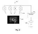 Fig. 08 - SYSTEMS AND/OR METHODS FOR STIMULATING THE BRAIN TO PROMOTE LEARNING AND/OR TO PROVIDE THERAPEUTIC TREATMENTS THERETO