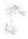 Fig. 06 - Pelvic structure for physical therapy device and head fastener for cervical traction