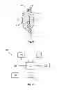 Fig. 02 - Glaucoma drainage device with pump