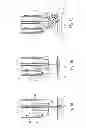 Fig. 02 - Hemostasis instrument