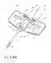 Fig. 02 - BLOOD ACCESS DEVICE