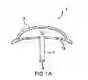 Fig. 02 - Pharmaceutical Delivery Device and Method for Providing Ocular Treatment
