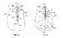 Fig. 04 - Needle cannula containing medicament