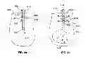 Fig. 05 - Needle cannula containing medicament