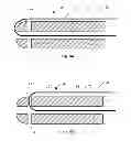 Fig. 07 - Drug eluting insert for implantable body