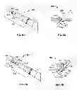 Fig. 06 - Anchoring an intravenous cannula